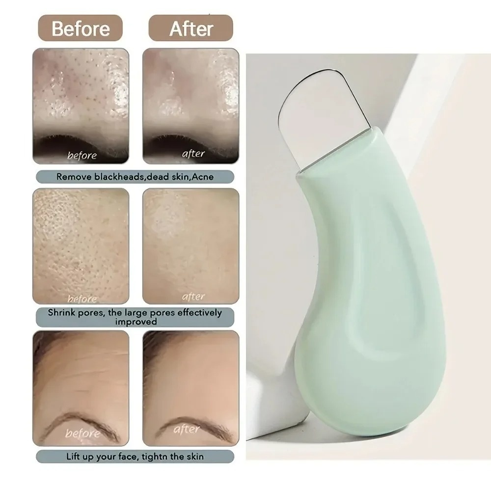 Alat Pembersih Komedo dan Whit - Nasal Aspirator ulasan dan harga